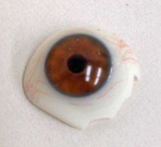 glass eye